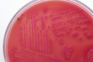 Escherichia coli (E. coli)